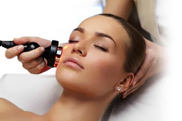 Radiofrecuencia facial